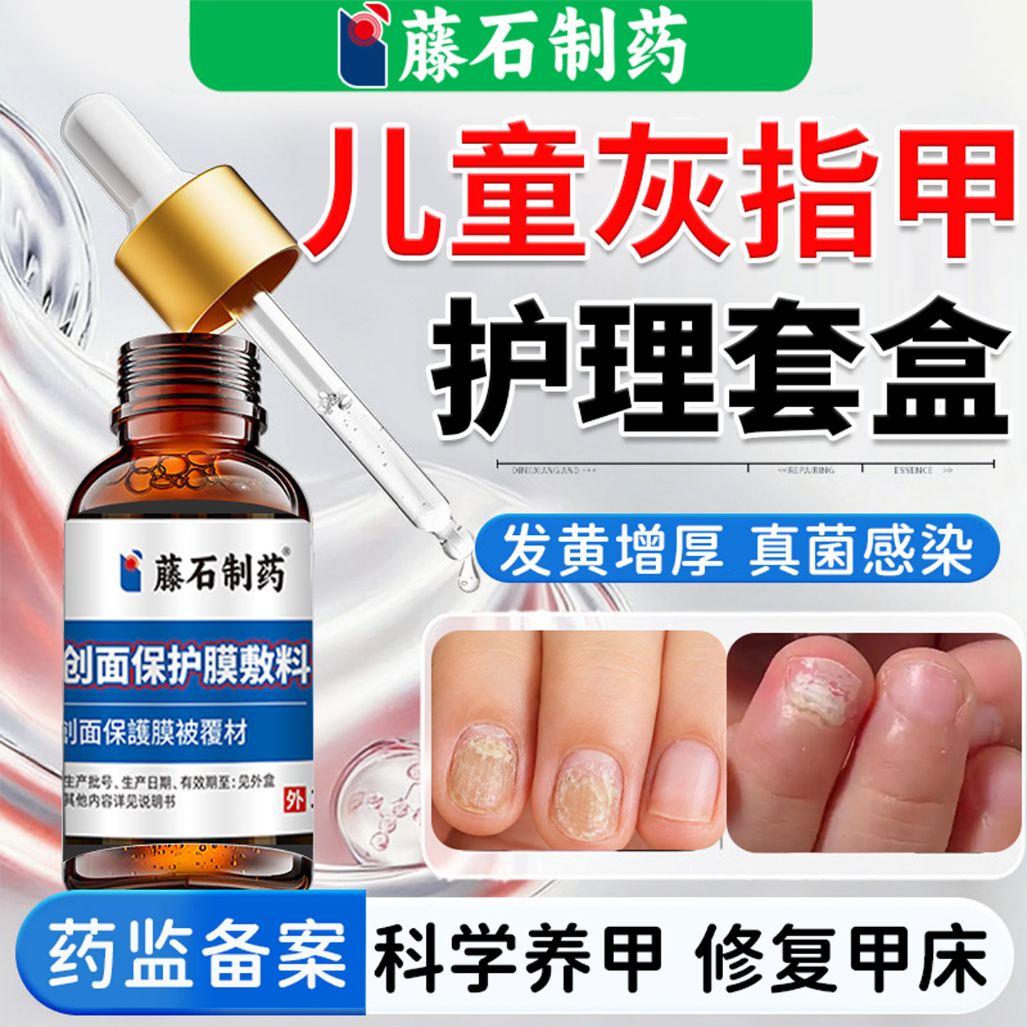 儿童灰指甲专用真菌感染发黄增厚指甲修复液药房抑菌液脱甲膏贴YZ