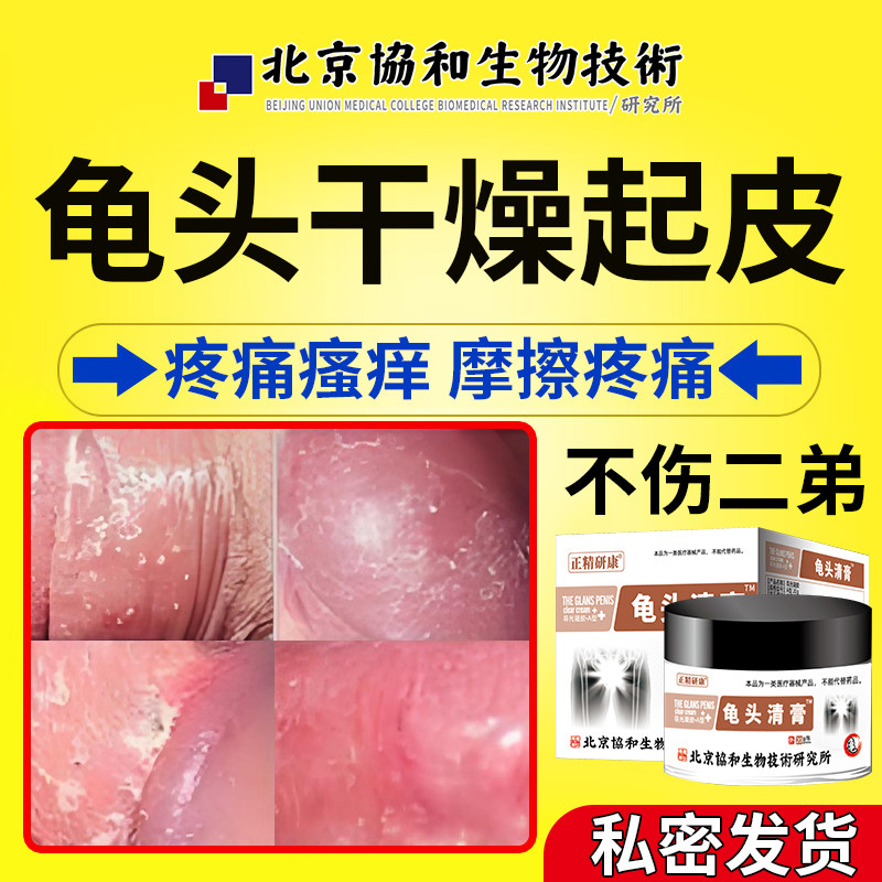 龟头皮肤角质化包皮龟头炎脱皮干燥红肿瘙痒专用可搭药膏用fbd