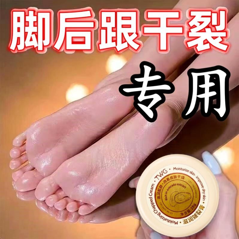 破裂膏脚后跟干裂霜龟裂手脱皮起皮皴裂膏脚裂滋润保湿护手霜通用