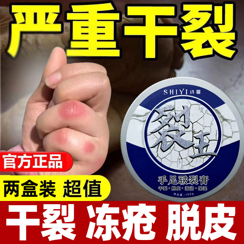 冻疮膏止痒冻伤膏皲裂膏手足脱皮膏防冻防裂护手霜裂口快速修复膏