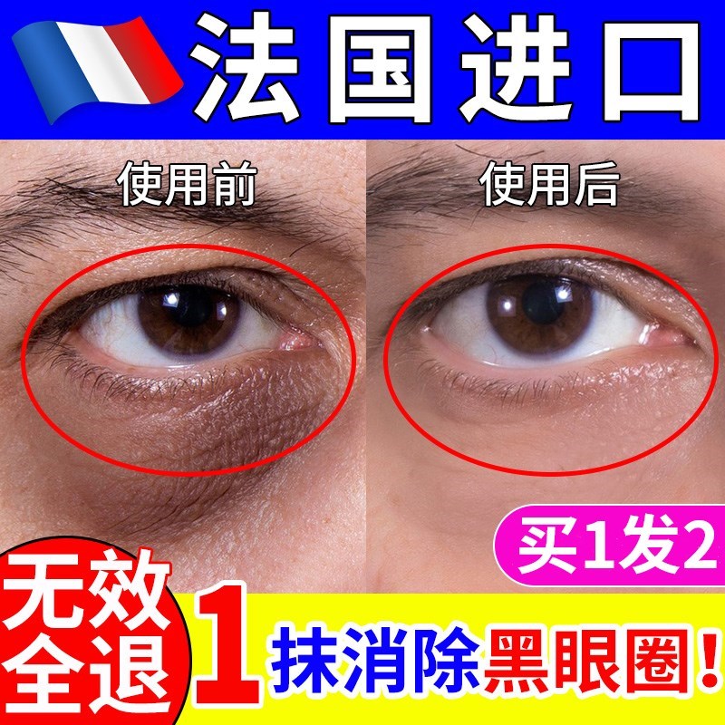 眼袋去除神器男士眼袋专用抗皱紧致抗衰老眼霜淡化黑眼圈细纹提拉