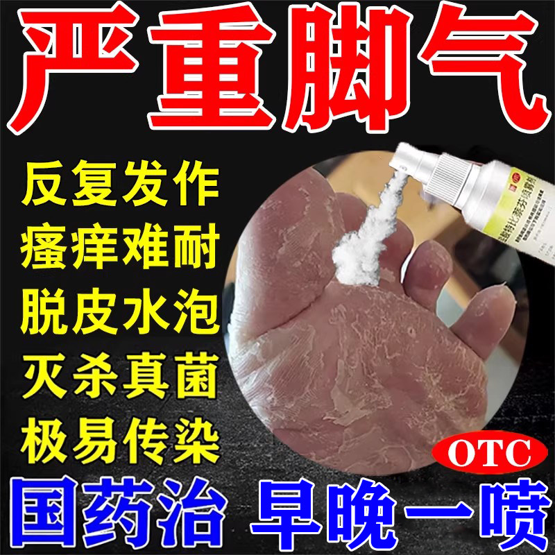 达克宁盐酸特比萘芬喷雾脚气药根止痒真菌感染水泡治烂脚丫专用药