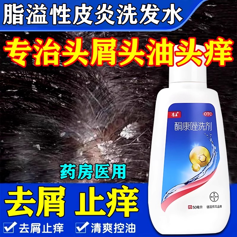 康王脂溢性皮炎洗发水酮康唑洗剂头皮屑去屑止痒毛囊炎专用洗发露