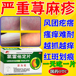 治疗寻荨麻疹过敏止痒断特的效专用药根氯雷他定片正品官方旗舰店