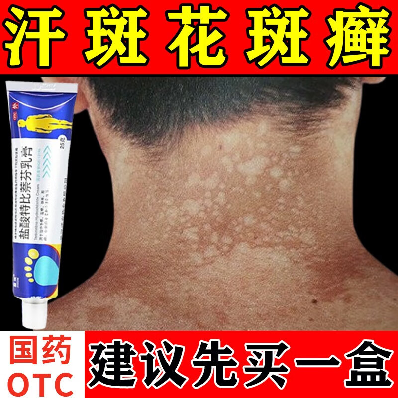 嘉效盐酸特比萘芬乳膏汗斑专用OTC药花斑癣汗斑真菌感染汗斑药膏