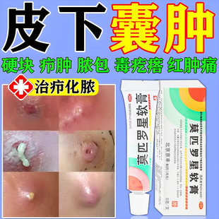 莫匹罗星乳膏正品火疖子拔毒软膏皮脂腺囊肿硬块红肿脓包消炎拔脓