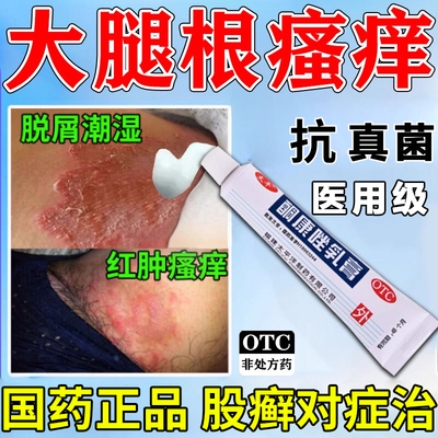 【太平】酮康唑乳膏2%*10g/盒