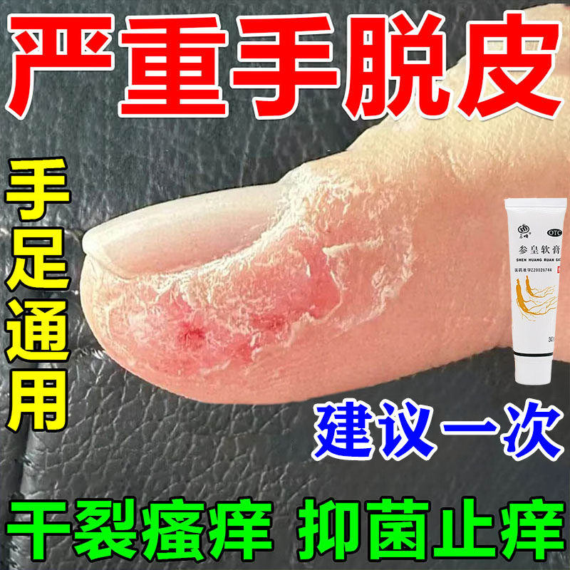 参皇软膏手干裂修复膏修复干裂粗糙淡化手纹手裂口脚后跟干裂,OTC药品/国际医药,抗菌消炎,淘宝优惠券,粉丝福利购,淘宝优惠卷