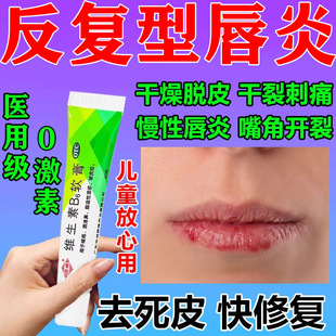 唇炎专用药嘴唇干裂脱皮儿童唇膏口角炎烂嘴角医用维生素b6软膏