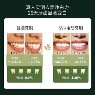 男女礼盒装 SVK电动牙刷全自动防水声波充电式 标配2个刷头 可使