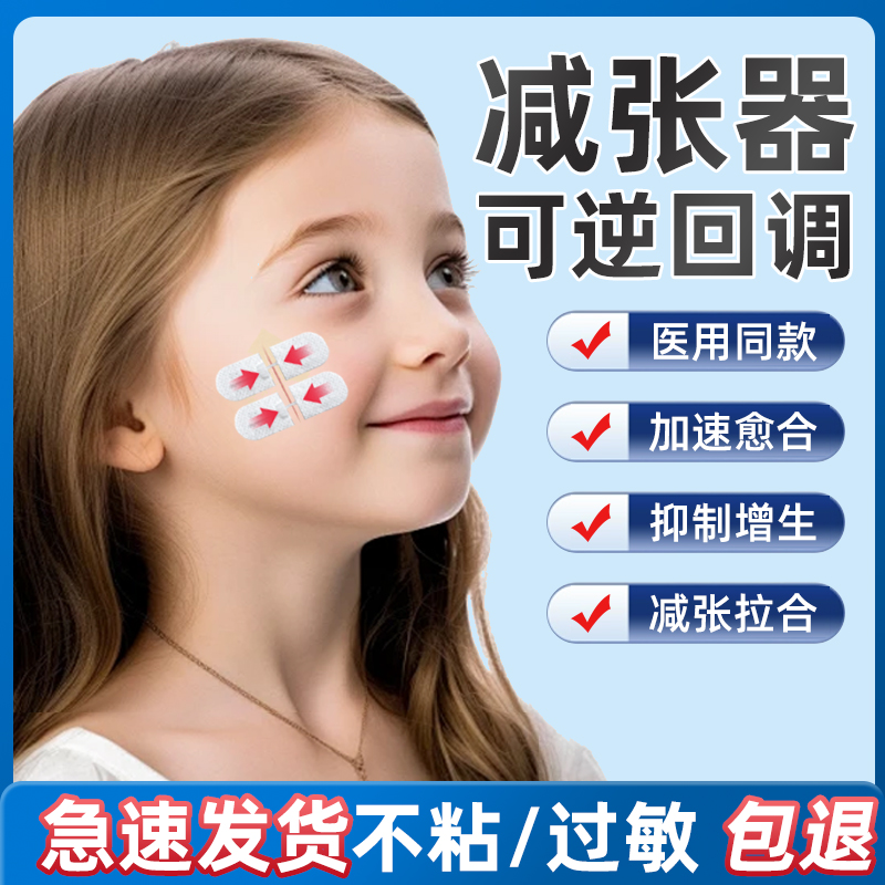 儿童减张器低致敏免缝合减张贴