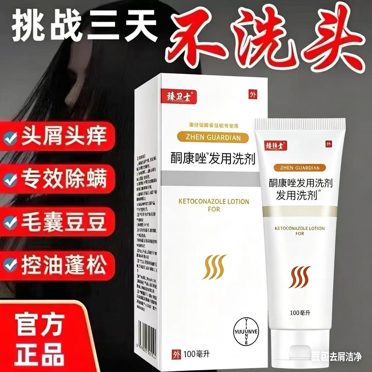 【药店同款】酮康强效去屑痒洗发水清洁去头皮经典老牌子洗发露