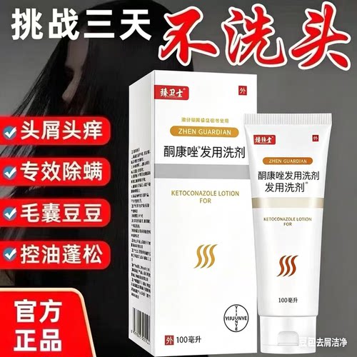 【药店同款】酮康强效去屑痒洗发水清洁去头皮经典老牌子洗发露