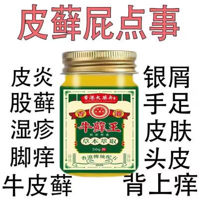 香港大药房牛藓王牛皮药头皮股银去屑皮肤杀菌病症止痒正品专用膏