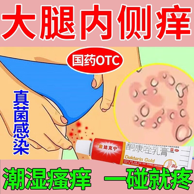 复方酮康唑乳膏正品股藓用药大腿内侧皮肤瘙痒股藓止痒去屁股