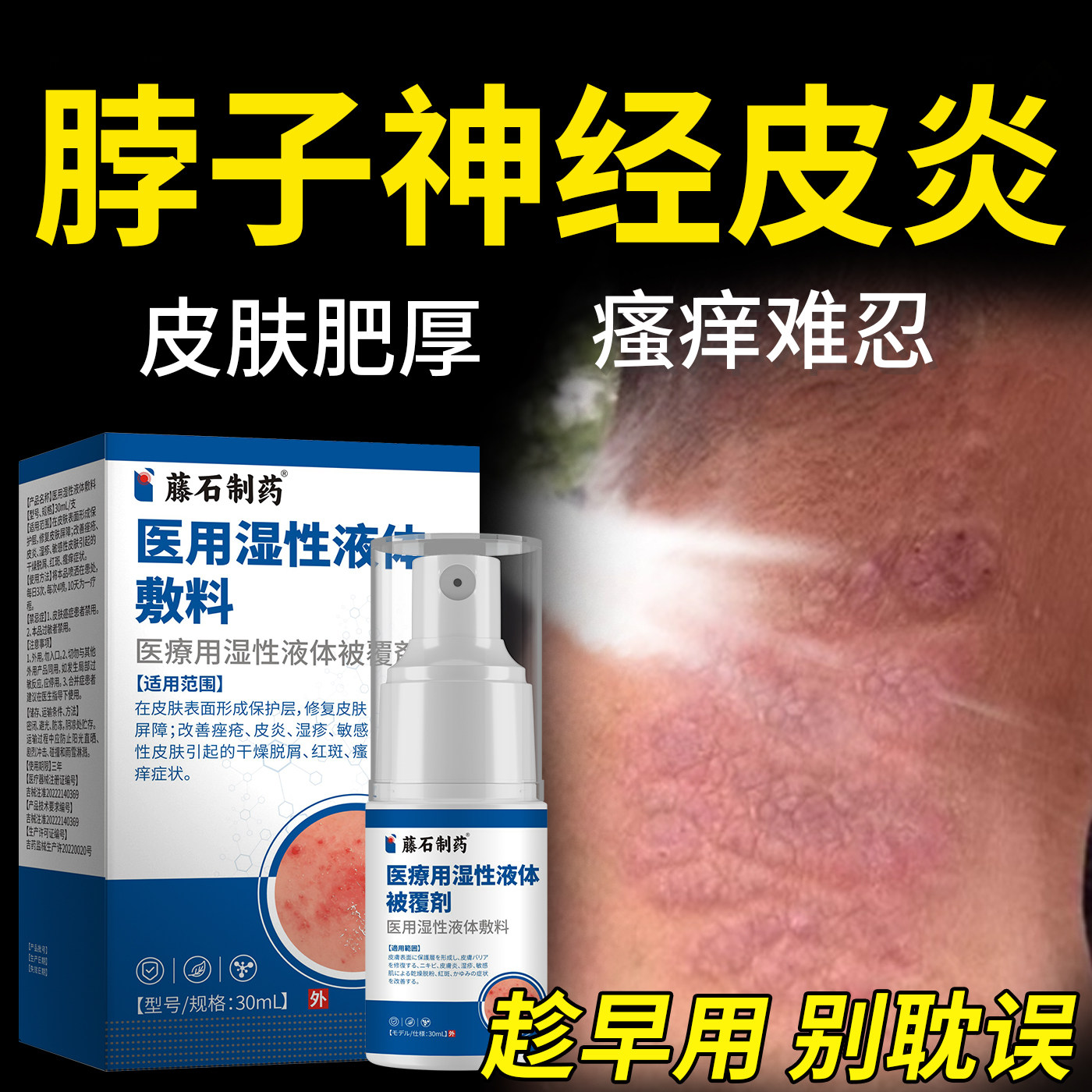 神经性皮炎喷剂脖子外用膏皮肤病癣藓湿疹真菌感染祛根止痒抑菌YM