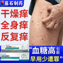 老年人糖尿病引起皮肤痒专用搭专治特皮肤瘙痒效的止痒药房膏用YS