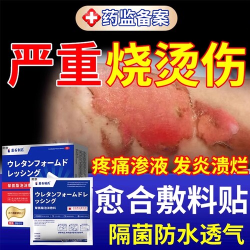 烫伤保护贴医用无菌性湿性愈合贴凝胶防水去黑色素沉淀儿童MP