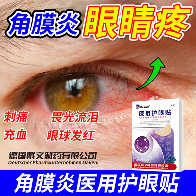 【角膜炎冷敷眼贴】医用级更放心