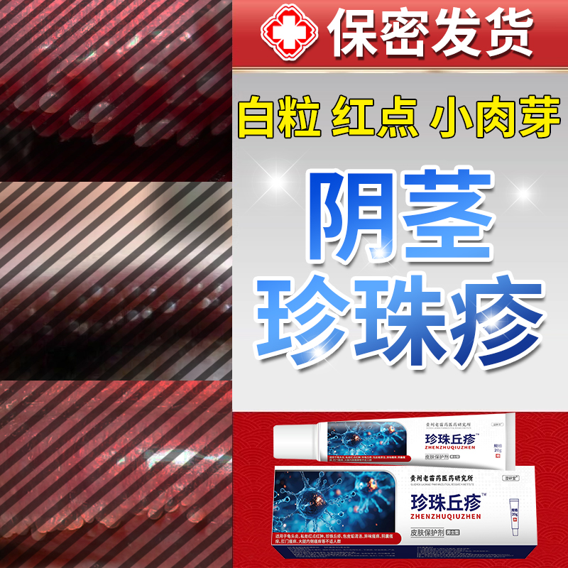 龟头阴茎珍珠状丘疹粒去除冠状沟皮水泡下面红肿豆腐渣白垢膏pa