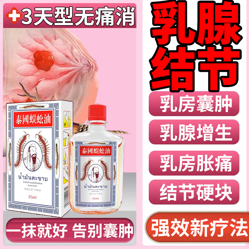 乳腺结节散结贴茶乳房炎疏通硬块囊肿中药胸部按摩器增生蜈蚣油DZ