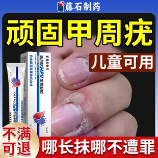 甲周疣专用手指硬皮手上长疣儿童去寻常疣根去除神器药房同款膏YS