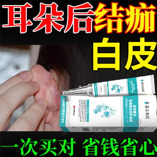 耳朵后面结痂有白皮耳朵痒止痒去干燥根起皮过敏红痒外耳道湿疹YM