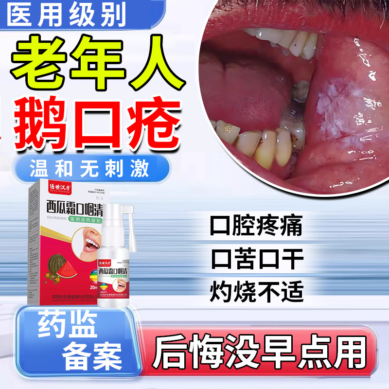 老人鹅口疮的喷剂碳酸氢钠制霉菌素混悬液雪口病修复药监备案pa