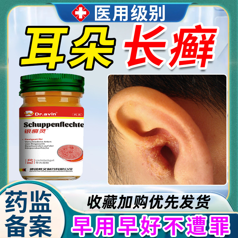 耳朵癣外耳道干燥起皮耳廓癣真菌感染湿疹银屑外用膏药房同款pa