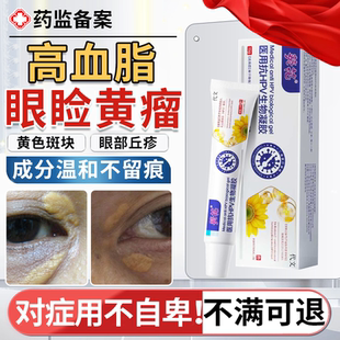 眼睑黄瘤去眼皮黄斑瘤专用膏眼角睑黄疣睑黄瘤去除非神器药房膏YS