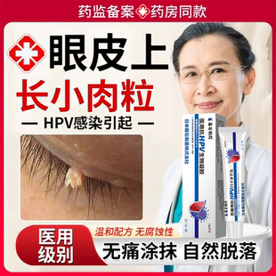 眼皮上长小肉粒丝状疣疙瘩去除神器专用祛疣瘊扁平疣药房同款膏EM