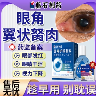 去除眼睛胬肉眼角长翼状胬肉息肉眼异物感专可搭滴眼液眼药水用EM