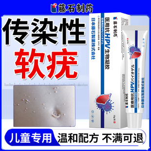 传染性软疣儿童病毒性软疣水猴子脖子上小肉粒丝状疣瘊子非镊子YM