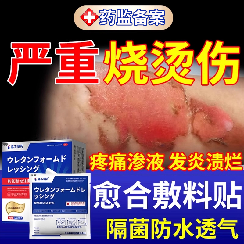 烫伤保护贴医用无菌性湿性愈合贴凝胶防水去黑色素沉淀儿童YM