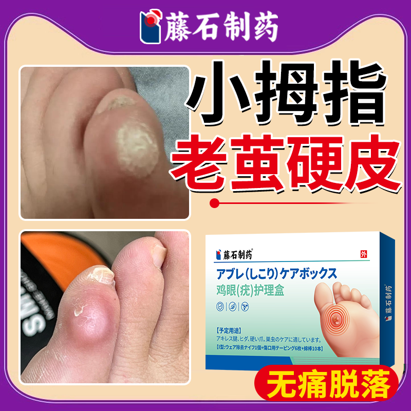 小脚趾去老茧软化剂去除死皮硬皮脚钉祛除膏脚底根厚脚垫硬疙瘩YS