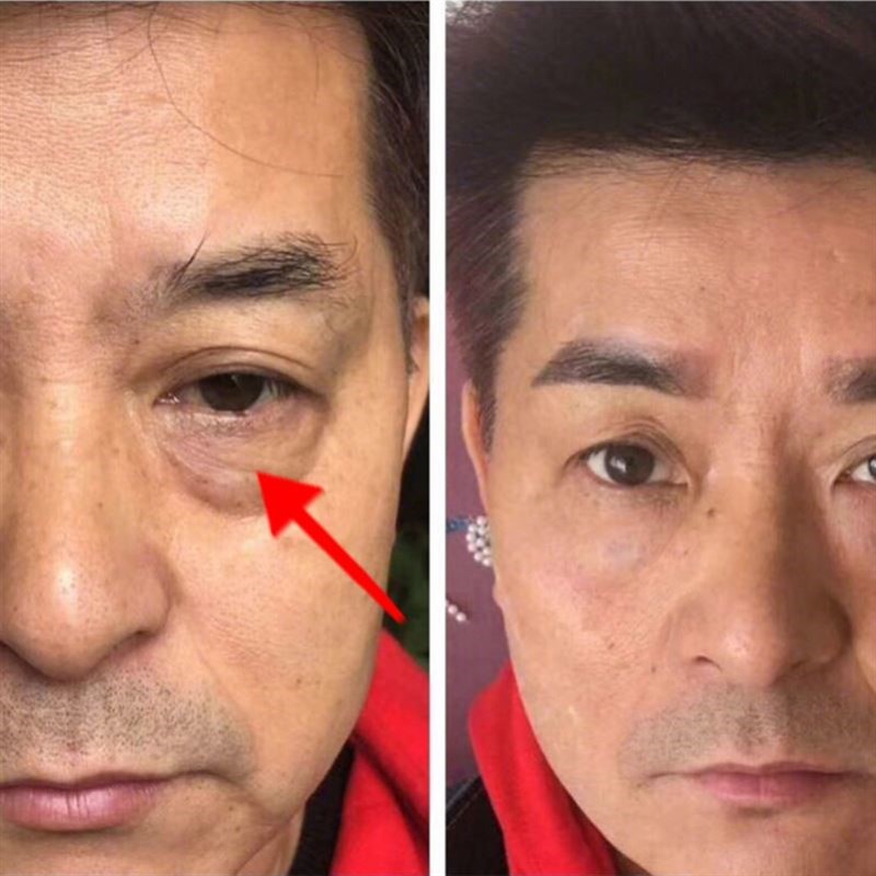 极速去眼袋消浮肿神器眼带霜男y士专用眼霜男祛眼代消除黑眼圈去