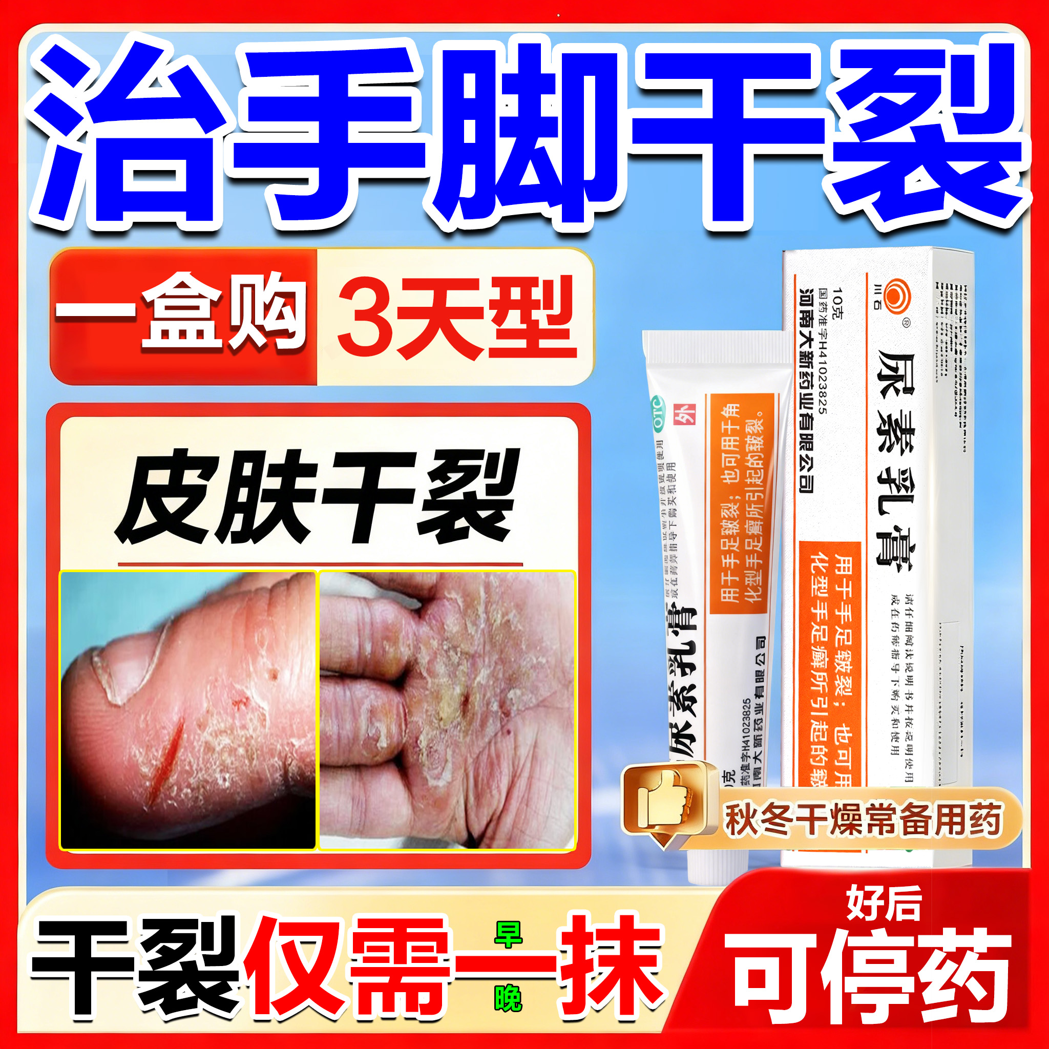 【川石】尿素乳膏10%*10g*1支/盒