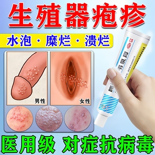 阿昔洛韦乳膏正品抗病毒外涂疱疹药单纯疱疹带状疱疹感染专用药膏