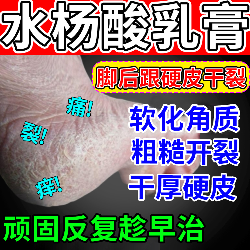 【信龙】水杨酸软膏5%*20g*1支/盒【脚后跟干裂起硬皮】