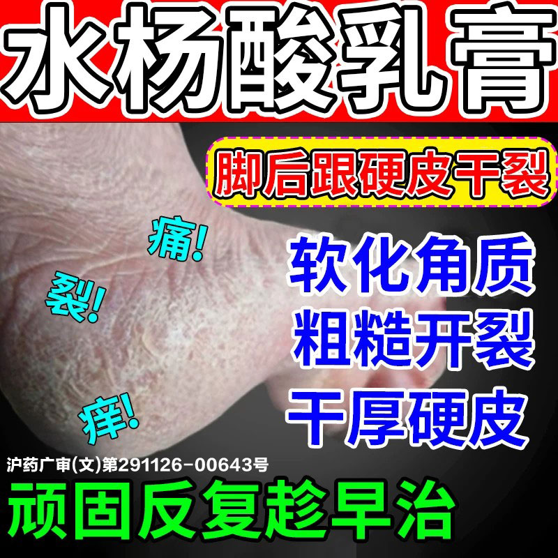 [信龙]水杨酸软膏5%*20g*1支/盒脚后跟干裂起硬皮