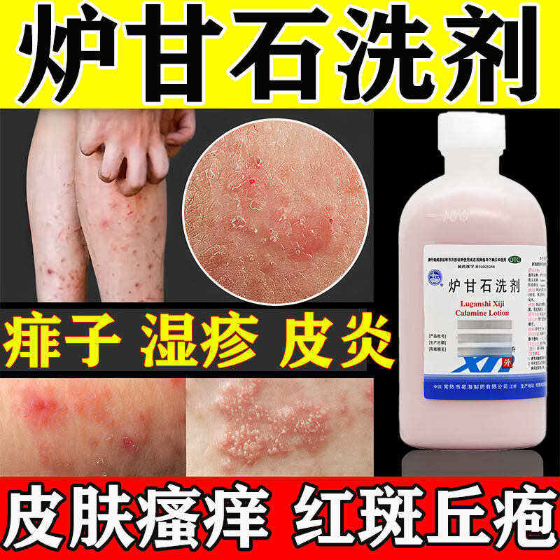 【星海】炉甘石洗剂100ml*1瓶/盒