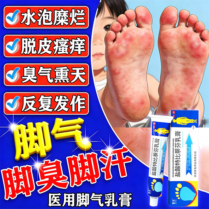盐酸特比萘芬乳膏正品去脚气止痒脱皮杀菌臭脚痒烂脚丫真菌感染