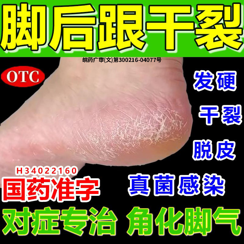 【君列王】尿素维E乳膏50g*1支/盒