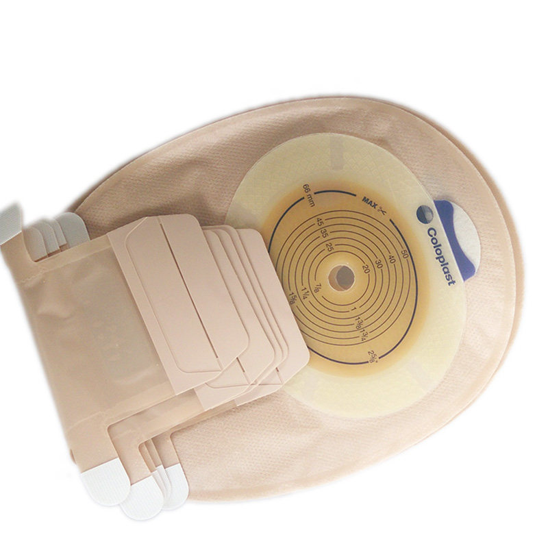 直肠癌人工直小肠假肛门排便袋代