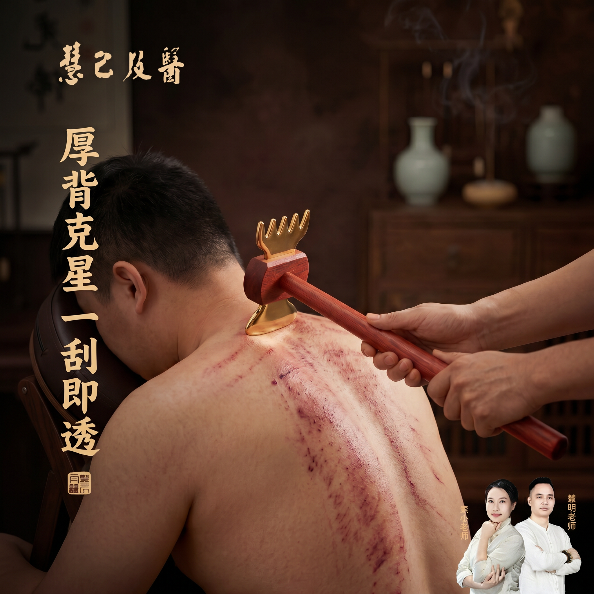 黄铜刮痧板长柄背部肉厚部位大面积刮痧板秒出痧全身通用刮痧神器