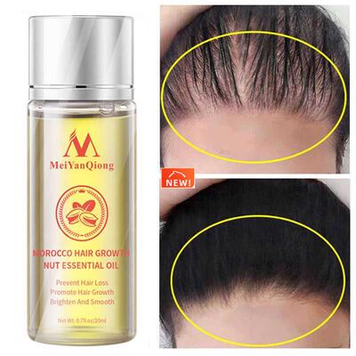 极速Moroccan iHair Growth Essential Oil Products Anti Hair L