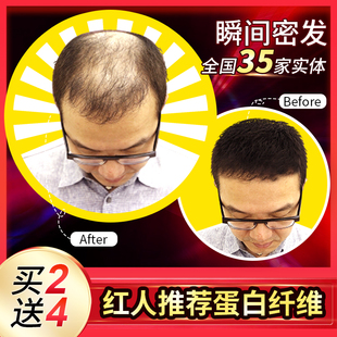 头发纤维粉增发补发视觉密发喷雾量增多发际线填充头顶稀少秃假发