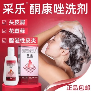 采乐酮康唑洗剂50ml头皮屑花斑藓汗斑脂溢性皮炎无激素医用洗发水