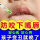 防咬下嘴唇神器小孩矫正器防止宝宝口呼吸儿童凸嘴手指仁和苦甲水