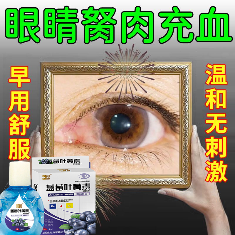 眼睛胬肉翼状胬肉眼角异物感发红模糊干涩看不清发痒滴眼液